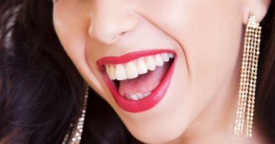 Tẩy trắng răng có tốt không? Ai không nên tẩy trắng răng?