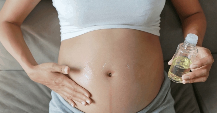 rạn da thời kỳ mang thai là nỗi lo của hầu hết chị em phụ nữ.